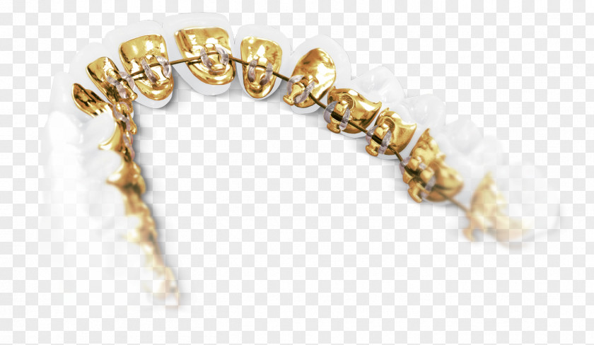 Braces Dentistry Clear Aligners Dental Orthodontics PNG