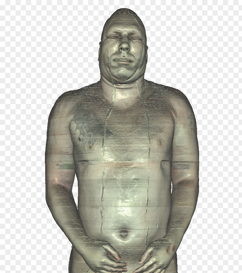 Ice Block Joseph Paul Jernigan Visible Human Project Homo Sapiens Anatomy Body PNG