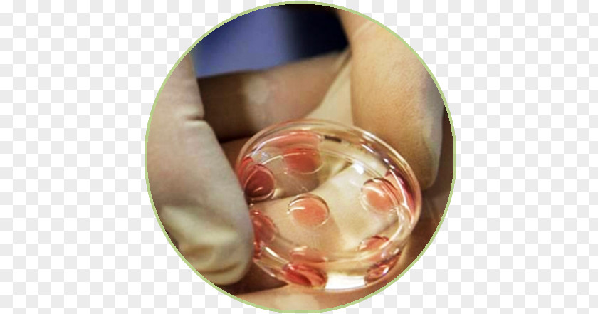 In Vitro Fertilisation Pregnancy Semen PNG