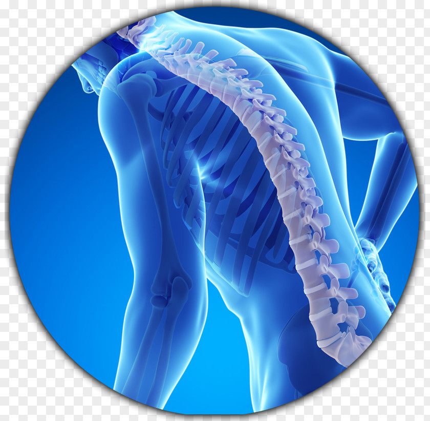 Health Osteoporosis Bone Fracture Disease Density PNG