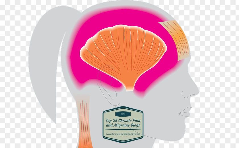 Migraine Relief Headache Symptom Therapy PNG