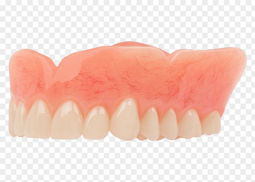 Denture Tooth Dentistry Dentures Aspen Dental PNG