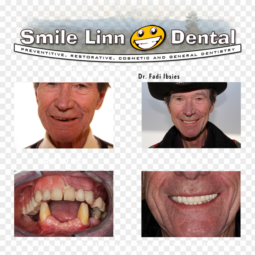 Lenz Lawrence J Dds Smile Linn Dental: Ibsies Fadi B DMD Dentistry Tooth Willamette River PNG