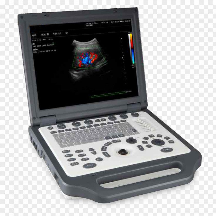 Sina Weibo Qq Space Wechat Ultrasonography Ultrasound Doppler Echocardiography Medical Equipment Medicine PNG