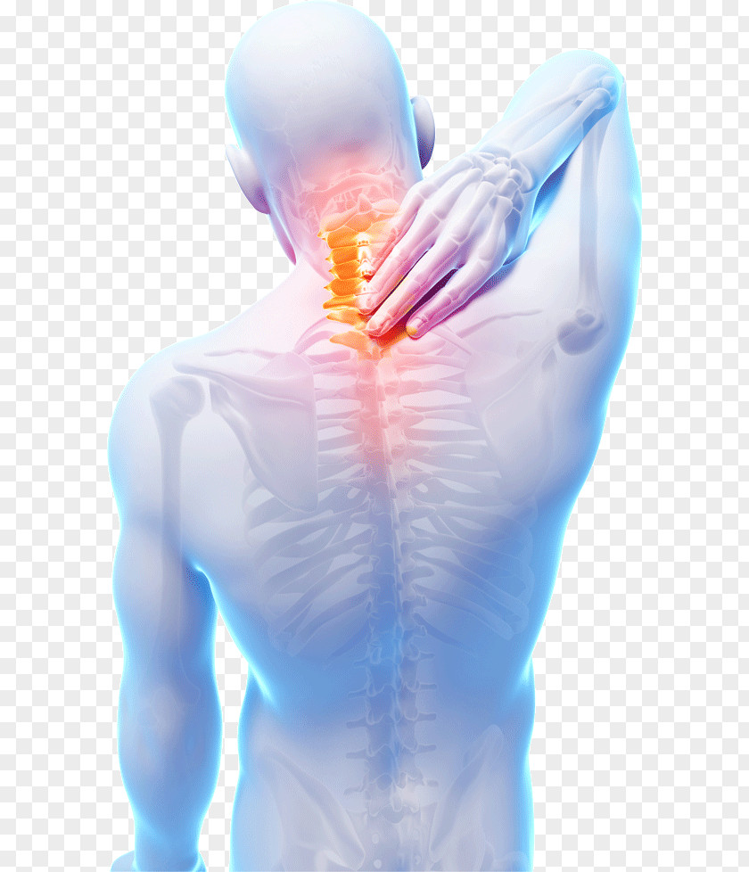 Neck Pain Myofascial Syndrome Muscle Chronic PNG