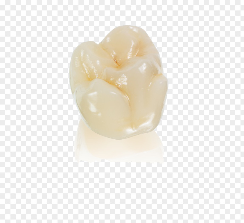 Dental Laboratory Crown Aesthetics Dentures ImplantCrystallize Vitallab PNG