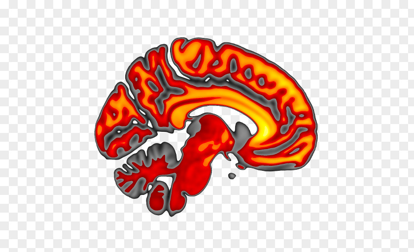 FMRIB Software Library Oxford Centre For Functional MRI Of The Brain Visualization Image Illustration PNG