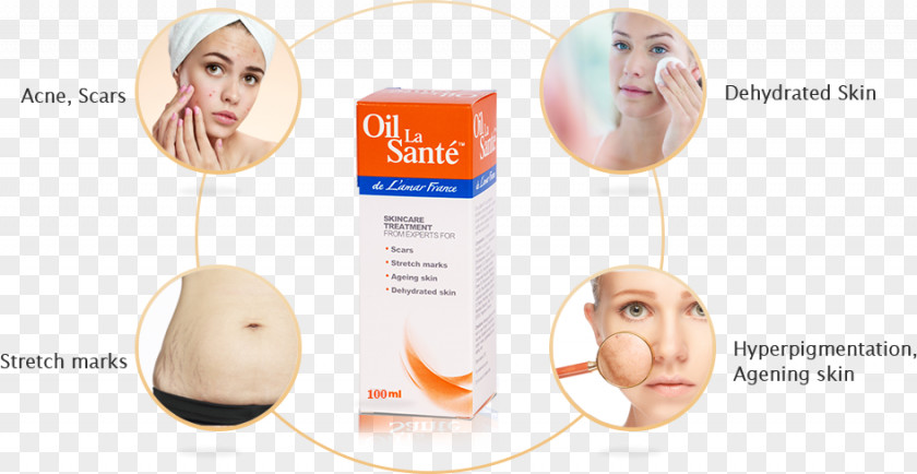 Skin Acne Dryness Oil Health Face Dehydration PNG