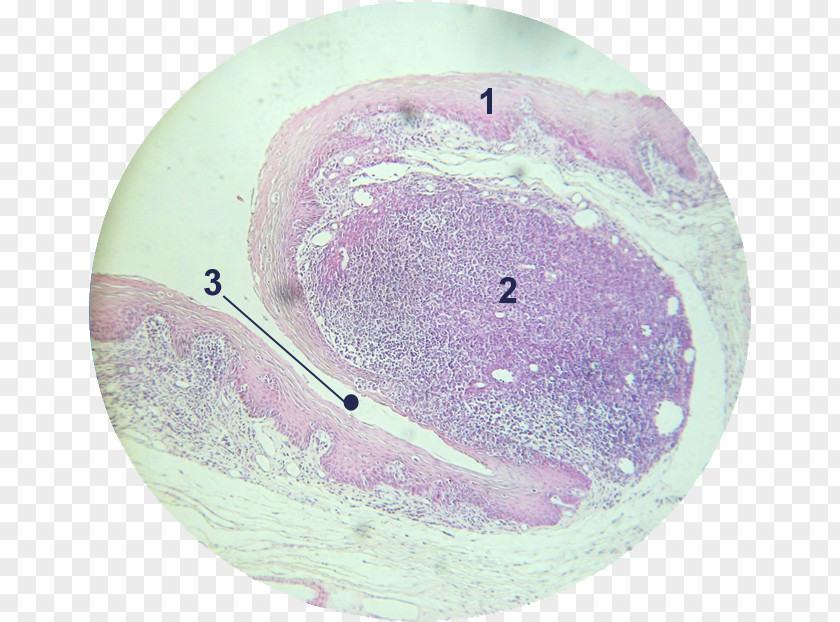 Stratified Tonsil Adenoid Epithelium Lingual Artery Histology PNG