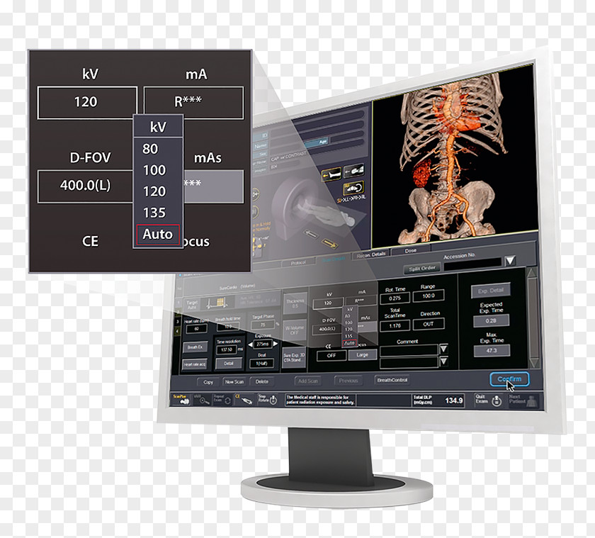 Computer Monitors Canon Medical Systems Corporation Toshiba Computed Tomography Image Scanner PNG