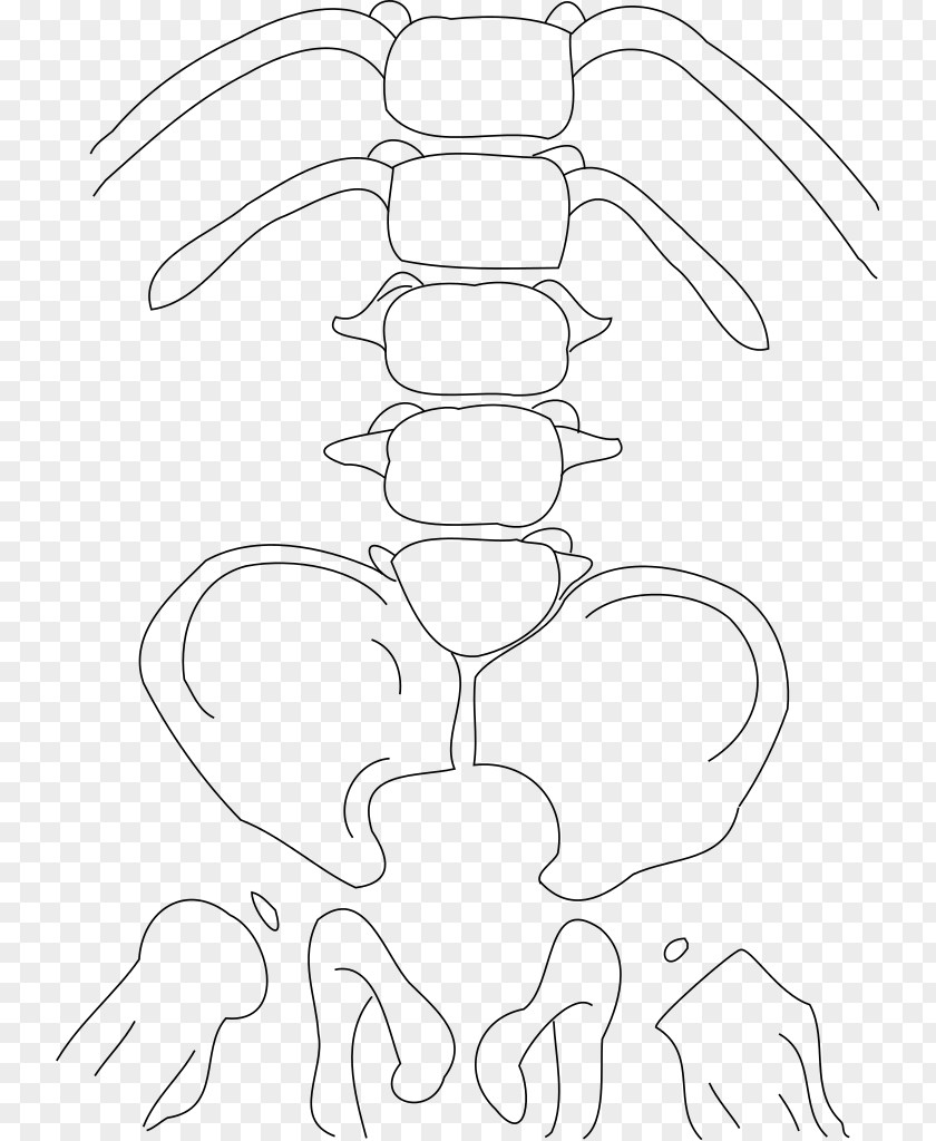 Sacrum Caudal Regression Syndrome Congenital Heart Defect Birth Genetic Disorder PNG