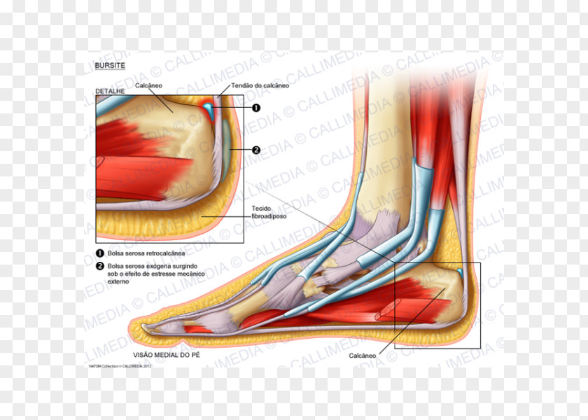 Fore Effect Muscle Foot Bursitis Synovial Bursa Knee PNG
