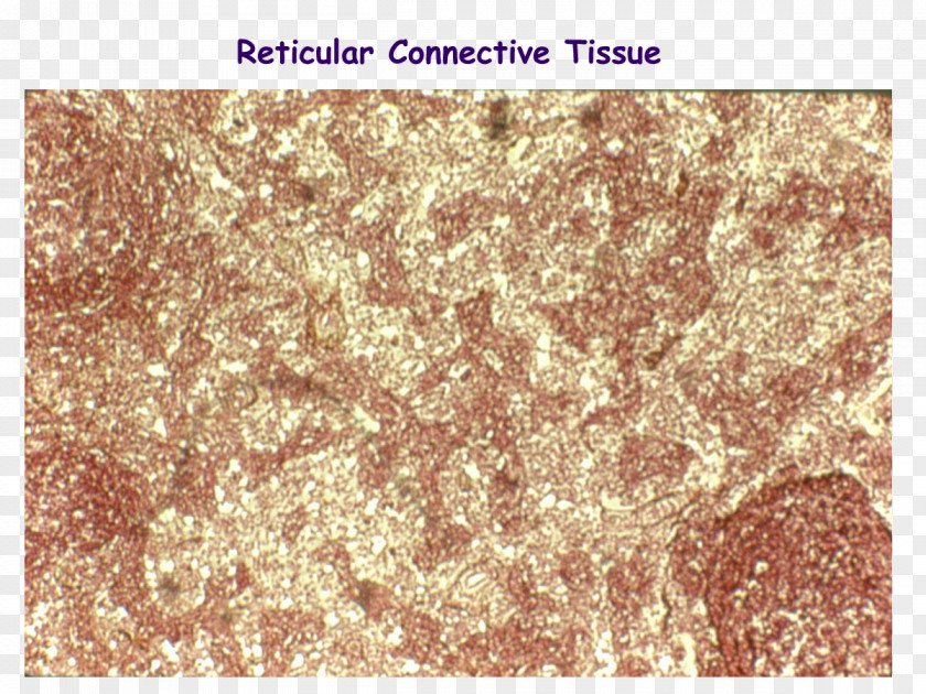 Reticular Connective Tissue Fiber Dense Irregular PNG