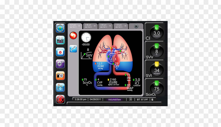 Physiology Cardiac Output Intensive Care Medicine PiCCO Edwards Lifesciences Monitoring PNG