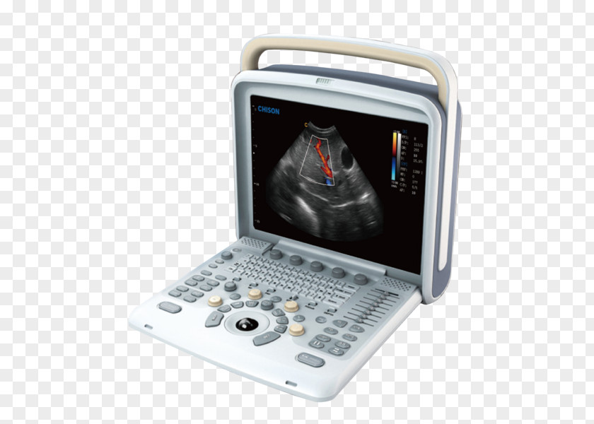 Ultrasonography Portable Ultrasound Doppler Echocardiography Medical Equipment PNG