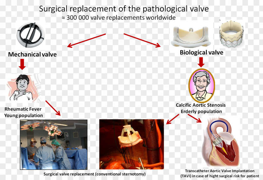 Design Brand Aortic Valve Valvular Stenosis PNG