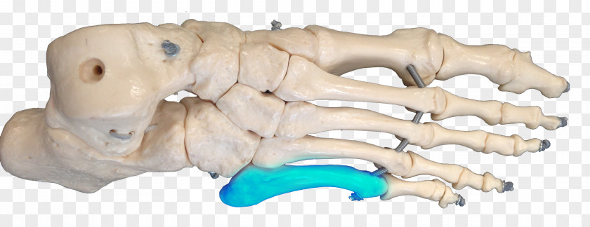 Jones Fracture Bone Metatarsal Bones Carolina Panthers Joint PNG