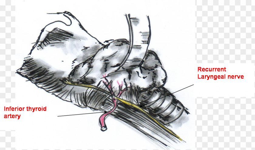 Recurrent Laryngeal Nerve Surgery Thyroidectomy /m/02csf Superior PNG