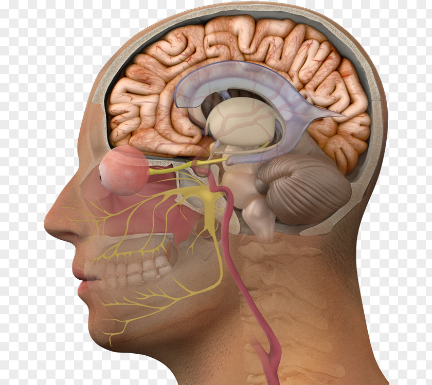 Brain Normal Pressure Hydrocephalus Disease Communicating PNG