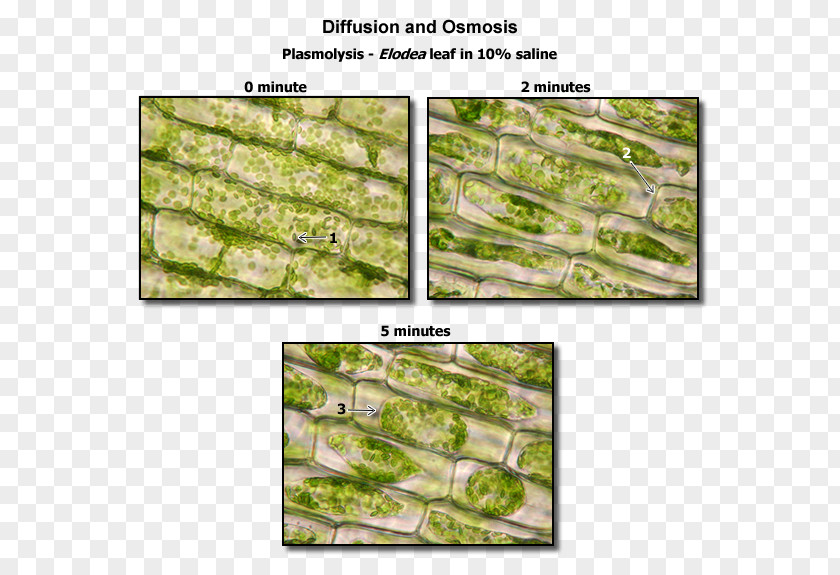 Body Muscle Anatomy Therapy Plasmolysis Plant Cell Elodea Biology PNG
