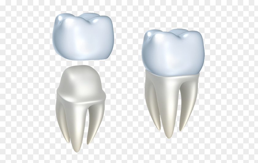 Angel Crown Dentistry Bridge Dental Restoration PNG