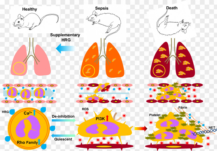 Blood White Cell Sepsis PNG