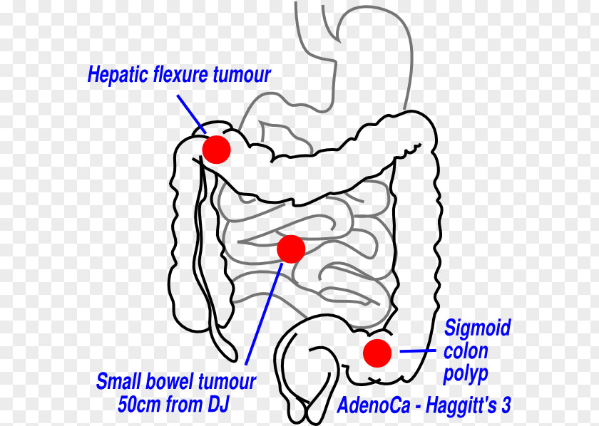 Multiple Clipart Large Intestine Small Gastrointestinal Tract Human Digestive System Anatomy PNG