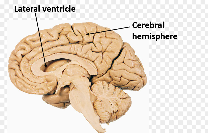 Brain Pituitary Gland Human Anatomy Corpora Quadrigemina PNG