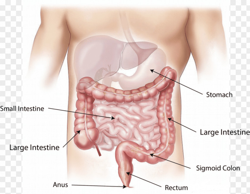 Health Colorectal Cancer Large Intestine Surgery Rectum PNG