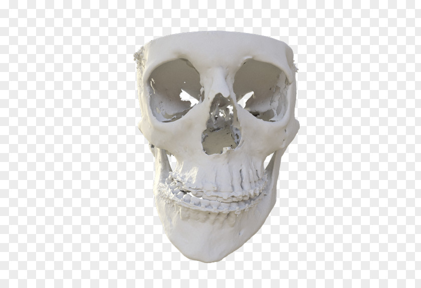 Skull MedCAD Surgery Skeleton Patient PNG