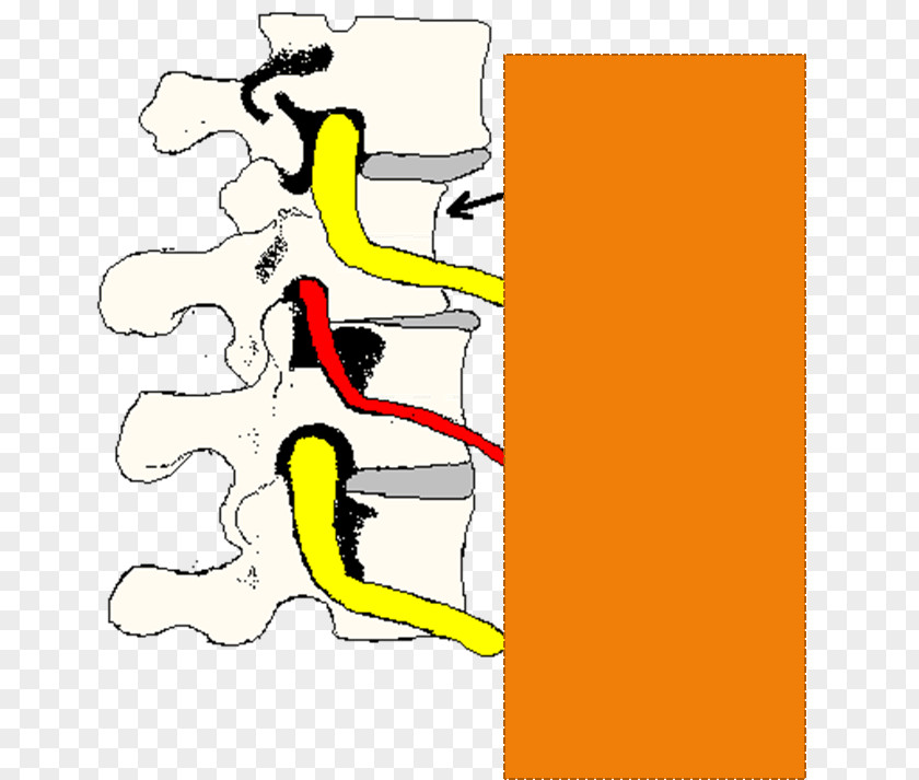 Phoenix Mountain Chiropractic Life Center Spinal Adjustment Vertebral Subluxation PNG