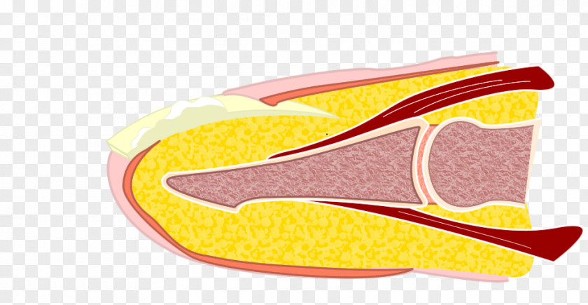 Design Shoe Onychomycosis PNG