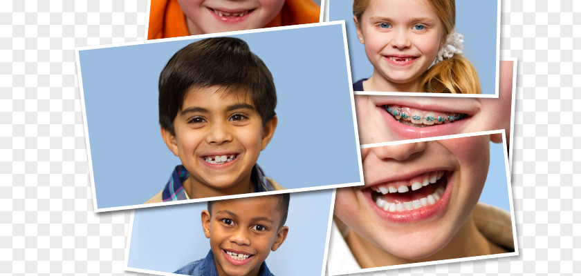 Child Stellar Kids Dentistry Mill Creek Pediatric PNG