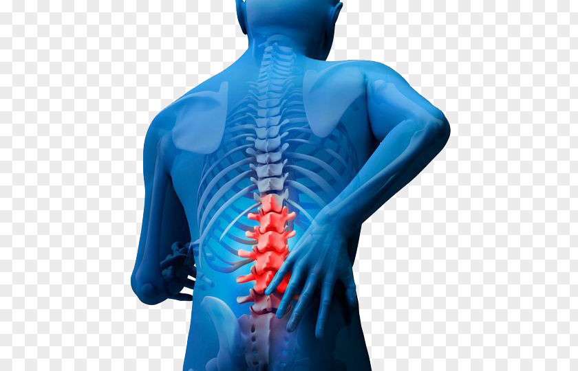Diadem Low Back Pain Vertebral Column Lumbar Spinal Fusion PNG