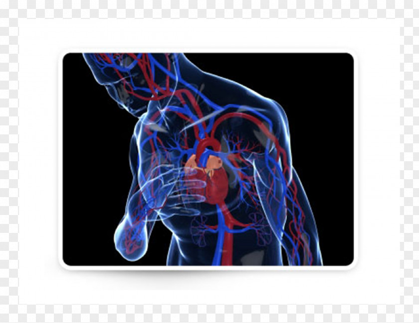 Heart Arrhythmia Myocardial Infarction Cardiac Arrest Cardiology PNG