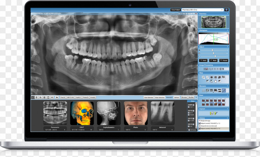 Dentistry Medicine Medical Imaging Dental Radiography Computer Monitors PNG