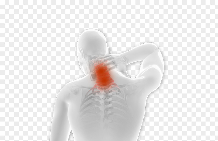 Back Pain Management Sciatica Spinal Cord Stimulator Epidural Administration PNG