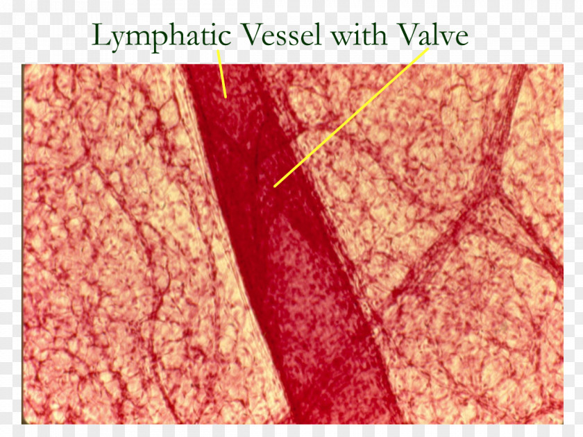 Histology Lymphatic Vessel System Lymph Node PNG