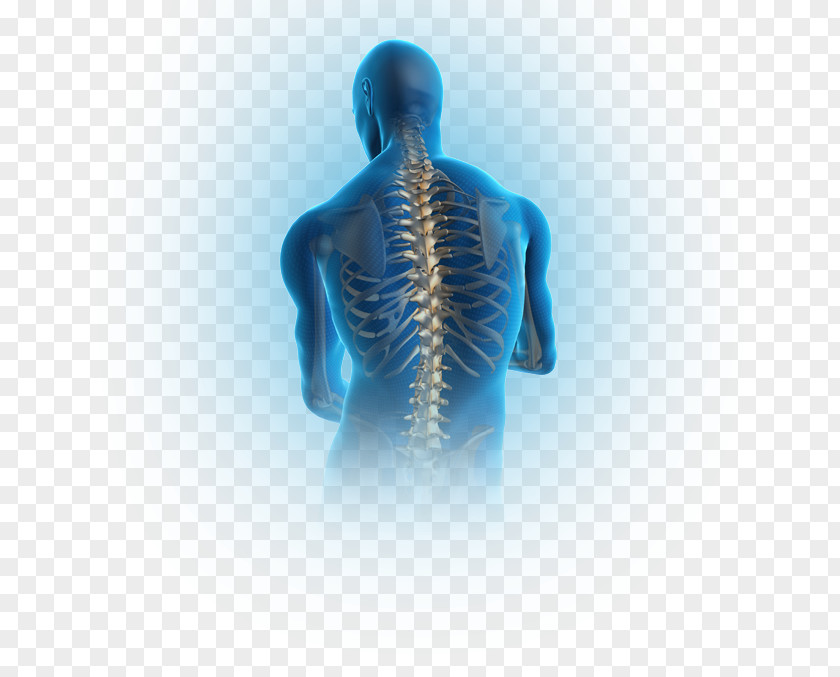 Scoliosis Pain In Spine Spinal Disc Herniation Vertebral Column Human Back Low PNG