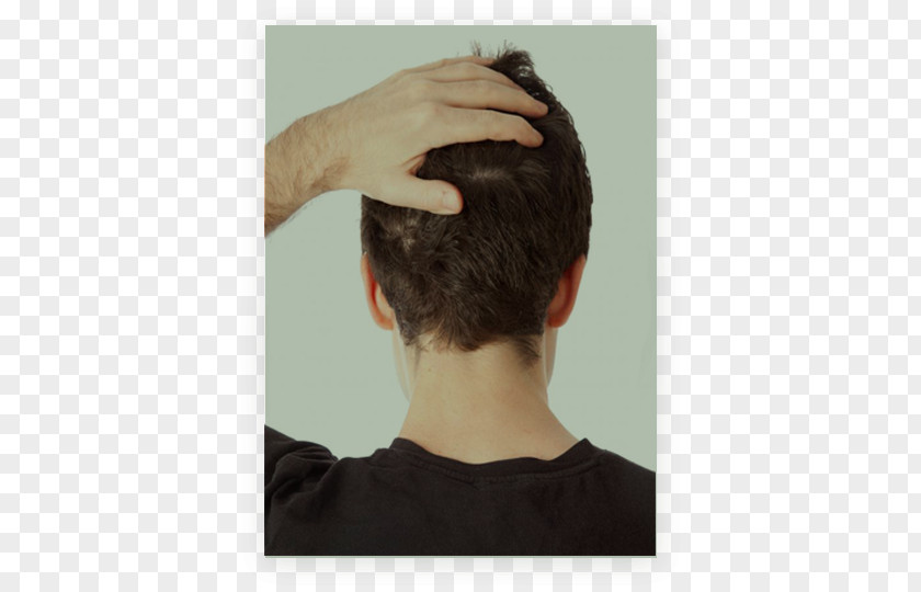 Hair Loss Scalp Nape Headache Pain PNG