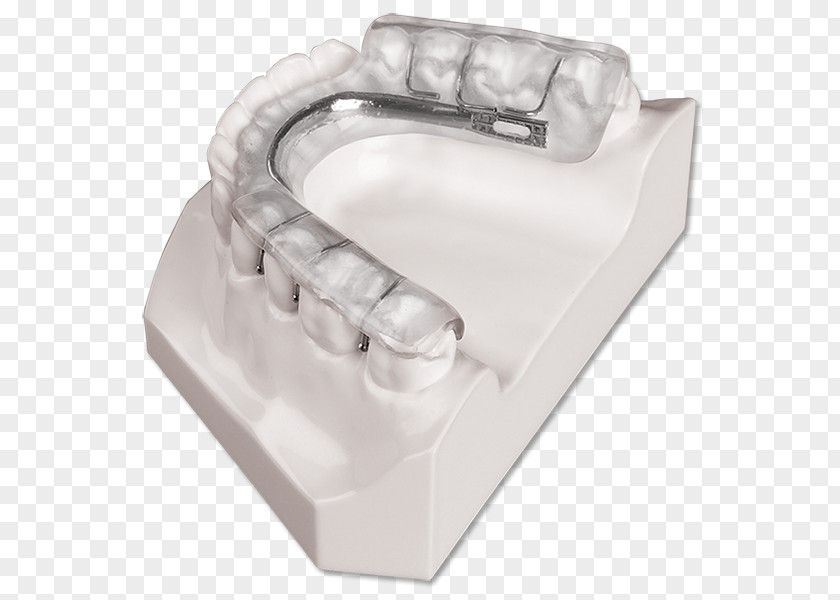 Mandibular Advancement Splints Splint Dentistry Temporomandibular Joint Dysfunction Therapy Orthopedic Surgery PNG