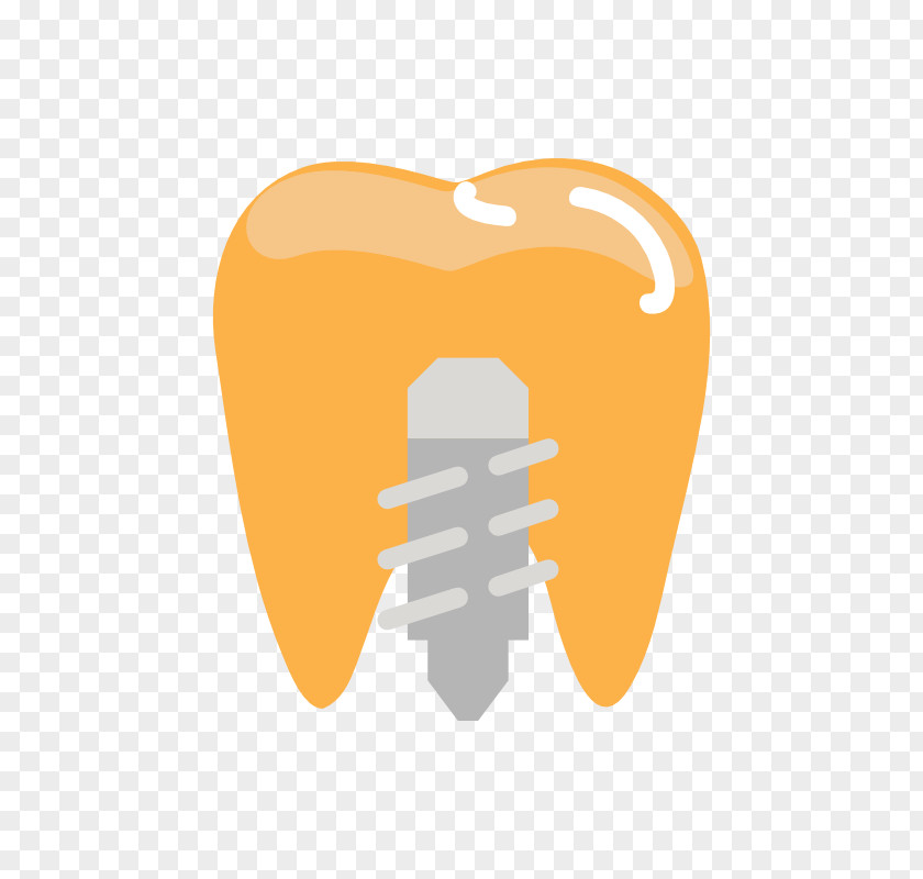 Implant Tooth Frankfort Smiles Dental North White Street Logo Dentist PNG