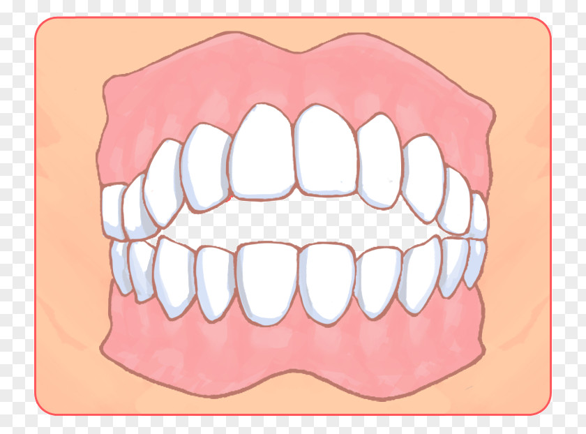 Shin 矯正歯科 Dental Braces Dentist Dentition Therapy PNG