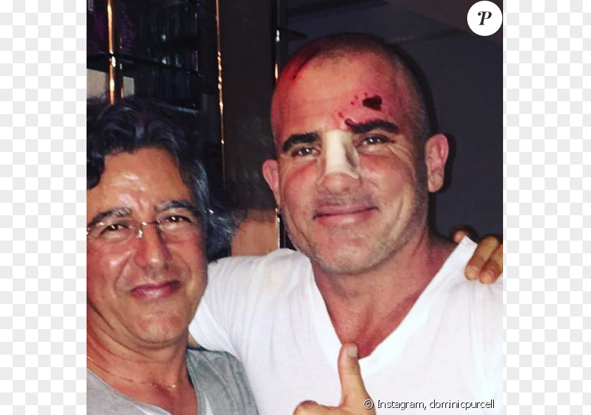 Accident Dominic Purcell Prison Break Death Injury PNG