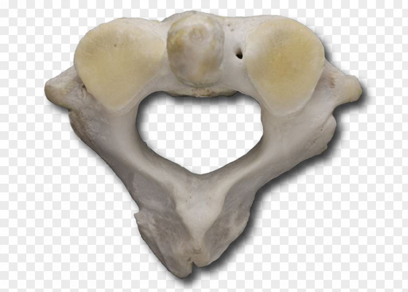 Cervical Vertebra Atlas Anatomy Bone Snout Vertebral Column PNG