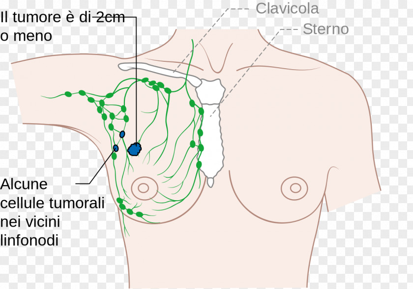 Arm Axilla Lymph Node Diagram PNG