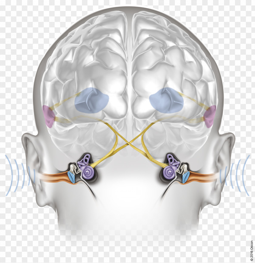 Ear Hearing Aid Audiometry Oticon PNG