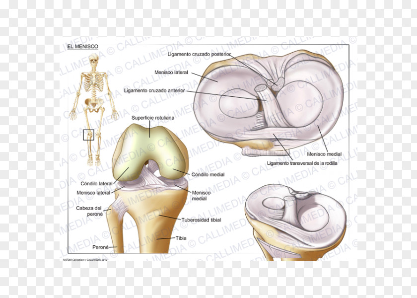 Ear Tear Of Meniscus Knee Joint PNG