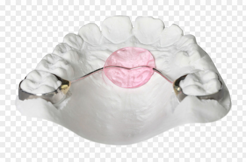 Orthodontics Orthodontic Technology Bionator Jaw Retainer PNG