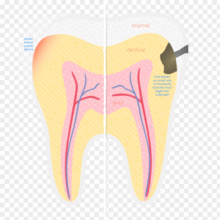 Drink Sports & Energy Drinks Human Tooth Decay Dentist PNG